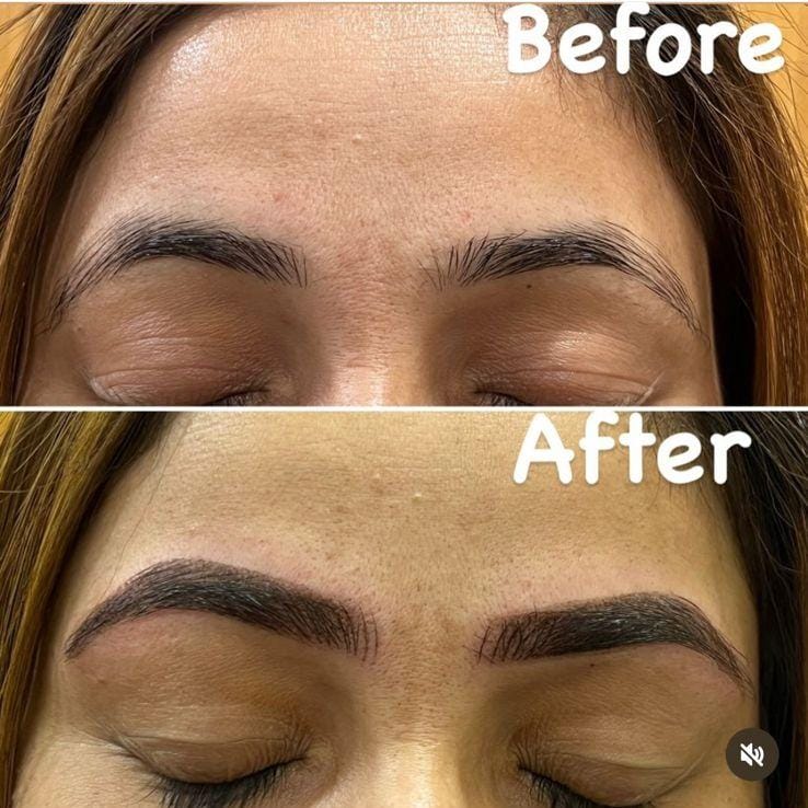 Before and after treatment comparison